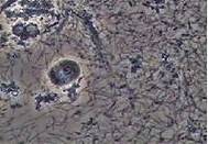 除菌前の顕微鏡画像 除菌前の顕微鏡画像