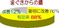 歯ぐきからの膿 歯ぐきからの膿